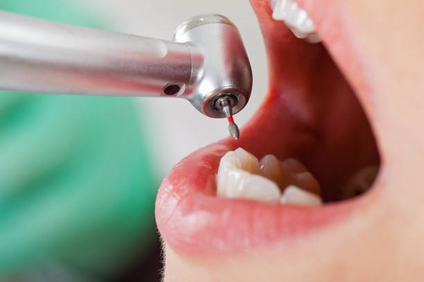 Best Mobile Emergency Dentist in Hobart, OK